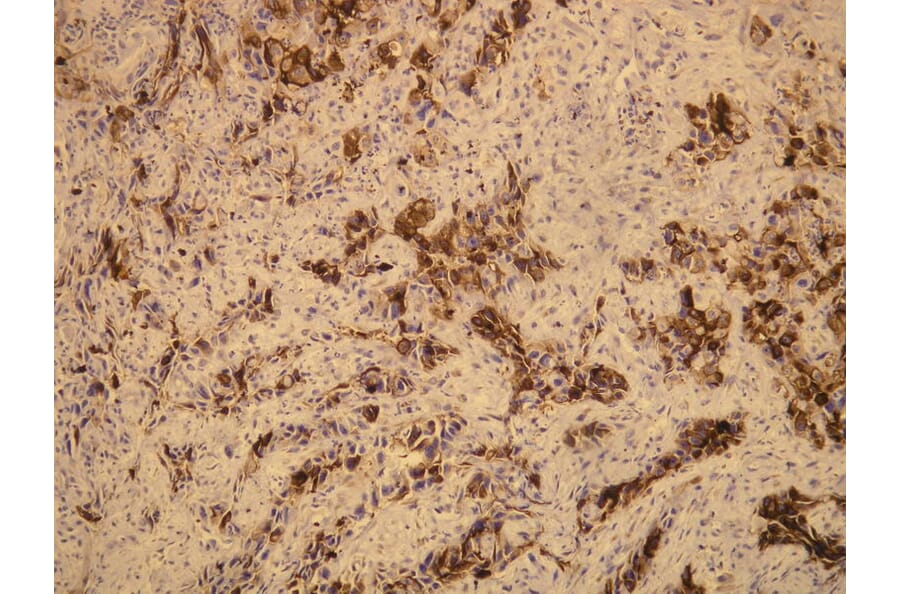 Immunohistochemistry - Anti-EMA Antibody - Antibodies.com (A8198)