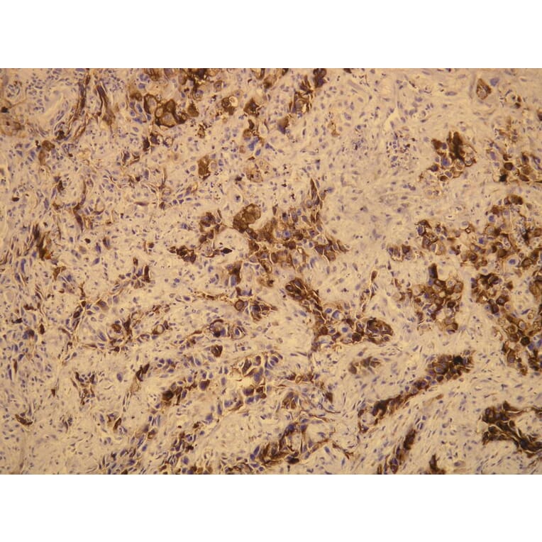 Immunohistochemistry - Anti-EMA Antibody - Antibodies.com (A8198)