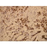 Immunohistochemistry - Anti-EMA Antibody - Antibodies.com (A8198)