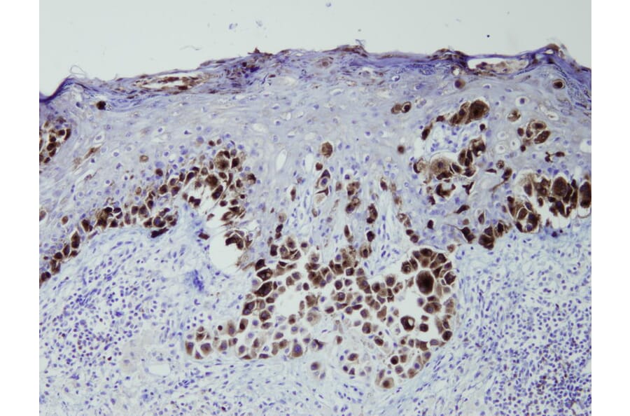 Immunohistochemistry - Anti-Melanosome Antibody - Antibodies.com (A8199)