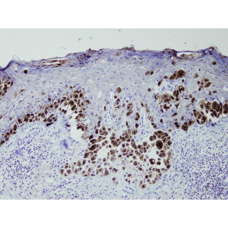 Immunohistochemistry - Anti-Melanosome Antibody - Antibodies.com (A8199)