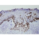 Immunohistochemistry - Anti-Melanosome Antibody - Antibodies.com (A8199)