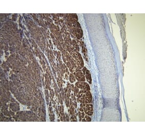 Immunohistochemistry - Anti-Melan A Antibody - Antibodies.com (A8200)