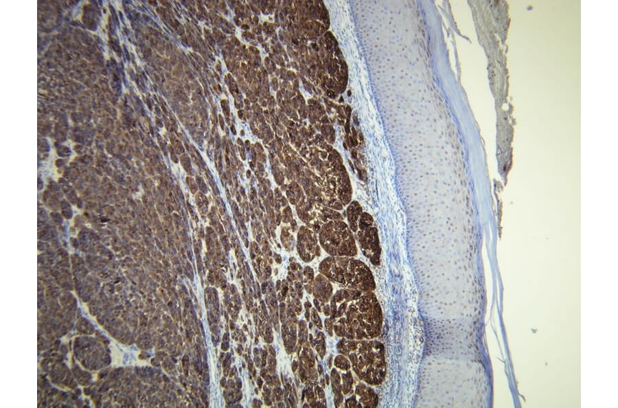 Immunohistochemistry - Anti-Melan A Antibody - Antibodies.com (A8200)
