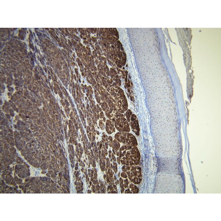Immunohistochemistry - Anti-Melan A Antibody - Antibodies.com (A8200)