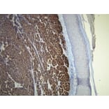 Immunohistochemistry - Anti-Melan A Antibody - Antibodies.com (A8200)