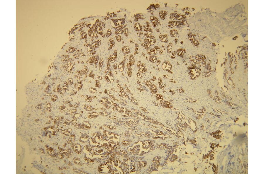 Immunohistochemistry - Anti-Cytokeratin 7 Antibody - Antibodies.com (A8201)