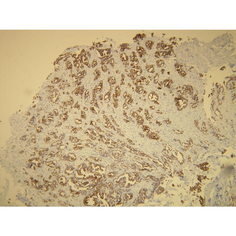 Immunohistochemistry - Anti-Cytokeratin 7 Antibody - Antibodies.com (A8201)