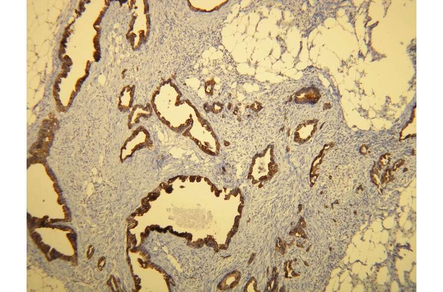 Immunohistochemistry - Anti-Cytokeratin 7 Antibody - Antibodies.com (A8201)