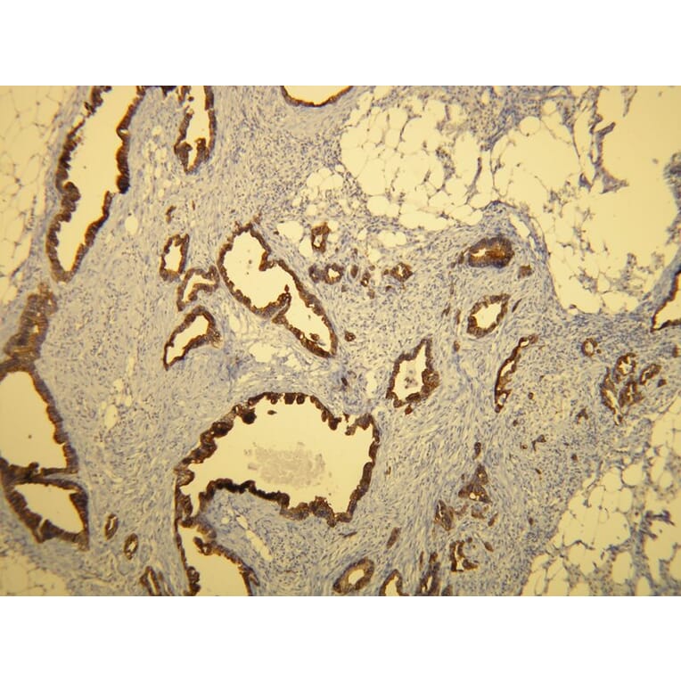 Immunohistochemistry - Anti-Cytokeratin 7 Antibody - Antibodies.com (A8201)