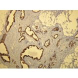 Immunohistochemistry - Anti-Cytokeratin 7 Antibody - Antibodies.com (A8201)