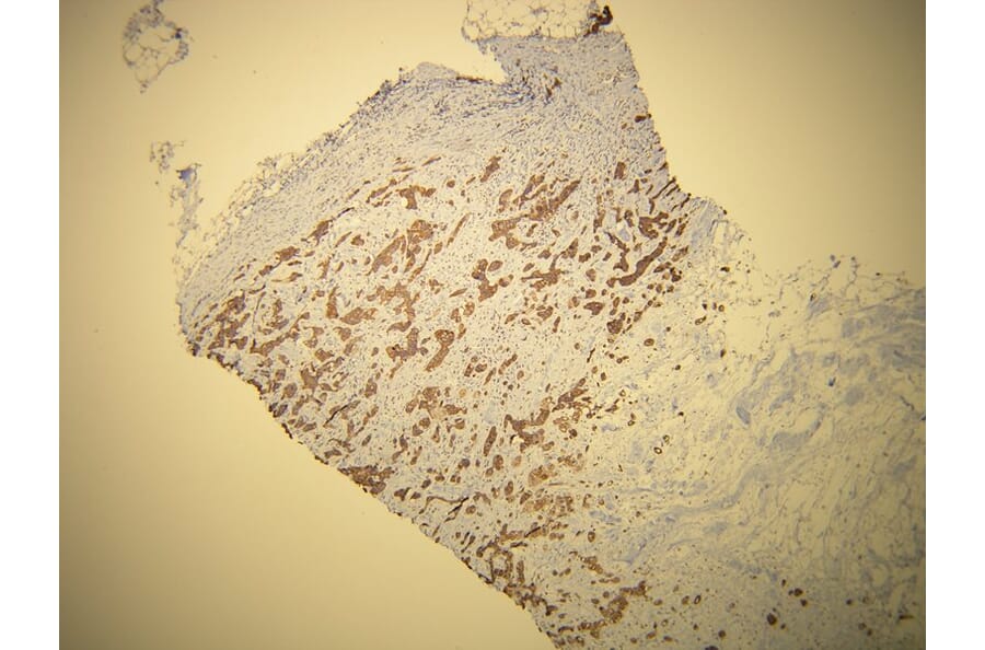 Immunohistochemistry - Anti-Cytokeratin 7 Antibody - Antibodies.com (A8201)