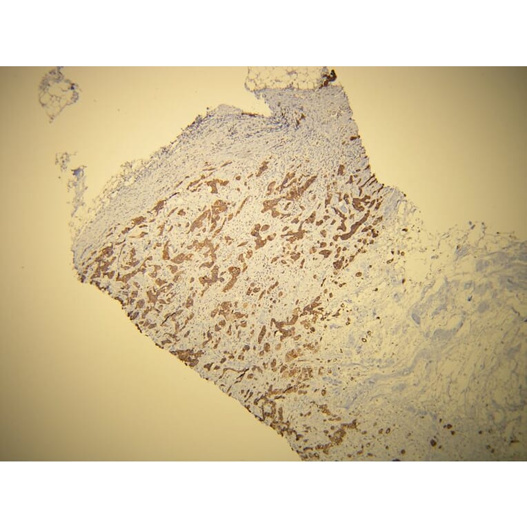 Immunohistochemistry - Anti-Cytokeratin 7 Antibody - Antibodies.com (A8201)