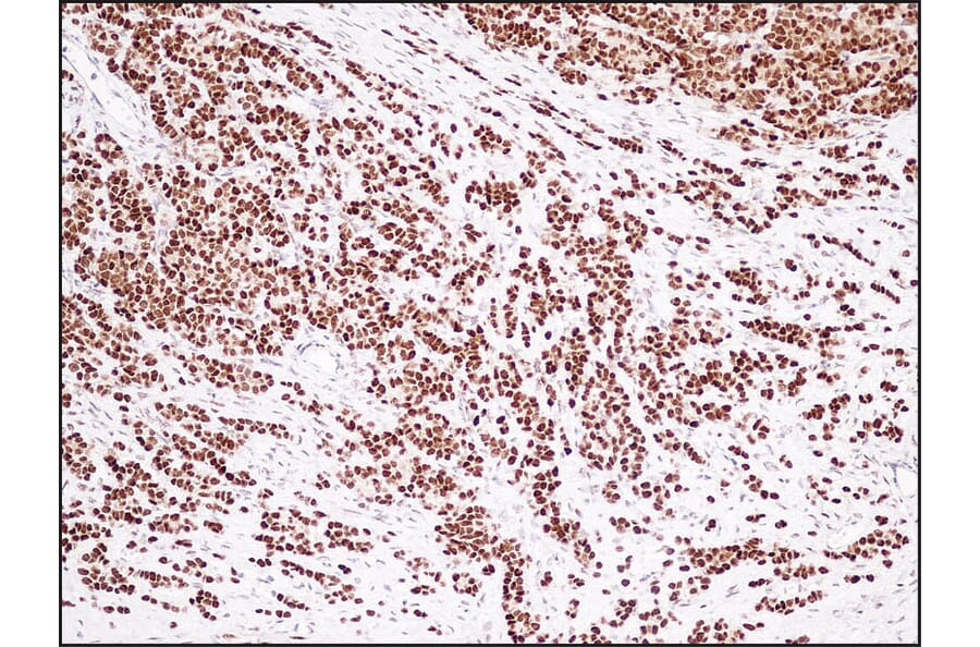 Immunohistochemistry - Anti-Estrogen Receptor Antibody - Antibodies.com (A8202)