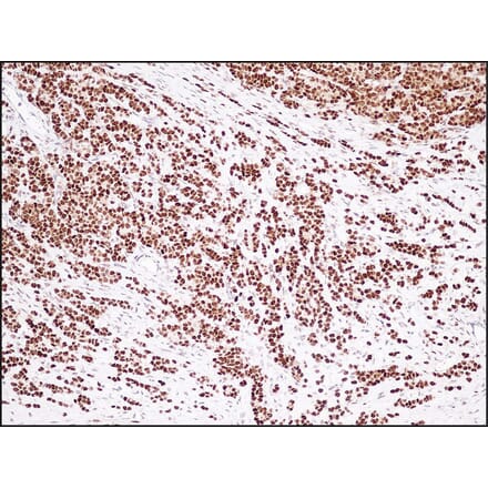 Immunohistochemistry - Anti-Estrogen Receptor Antibody - Antibodies.com (A8202)