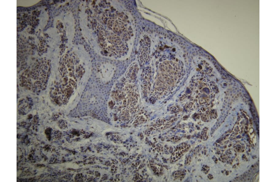 Immunohistochemistry - Anti-S-100 Antibody - Antibodies.com (A8203)