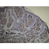 Immunohistochemistry - Anti-S-100 Antibody - Antibodies.com (A8203)