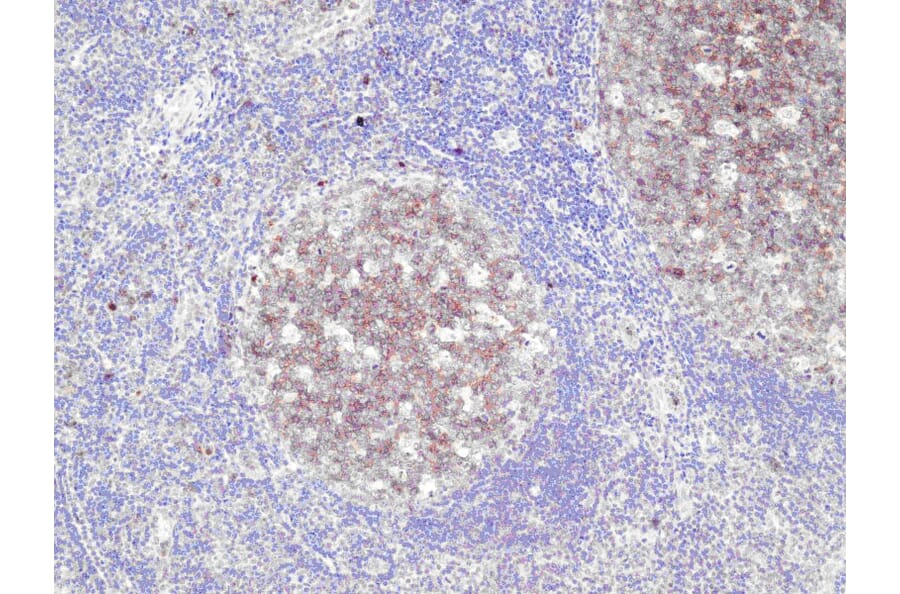 Immunohistochemistry - Anti-CD10 Antibody - Antibodies.com (A8204)