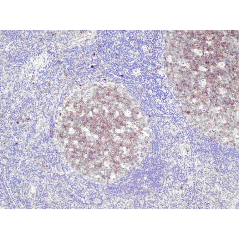 Immunohistochemistry - Anti-CD10 Antibody - Antibodies.com (A8204)