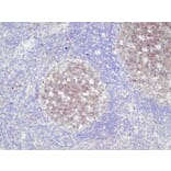 Immunohistochemistry - Anti-CD10 Antibody - Antibodies.com (A8204)
