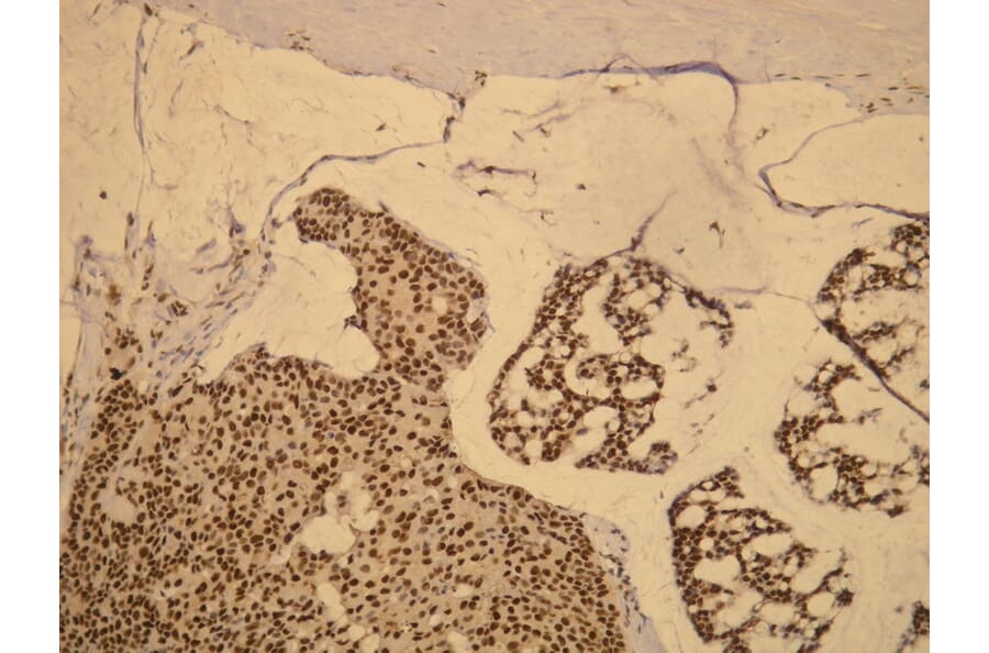 Immunohistochemistry - Anti-Progesterone Receptor Antibody - Antibodies.com (A8205)