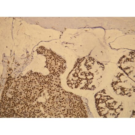 Immunohistochemistry - Anti-Progesterone Receptor Antibody - Antibodies.com (A8205)