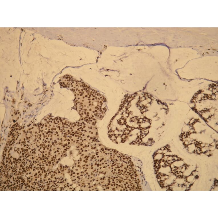 Immunohistochemistry - Anti-Progesterone Receptor Antibody - Antibodies.com (A8205)