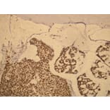 Immunohistochemistry - Anti-Progesterone Receptor Antibody - Antibodies.com (A8205)
