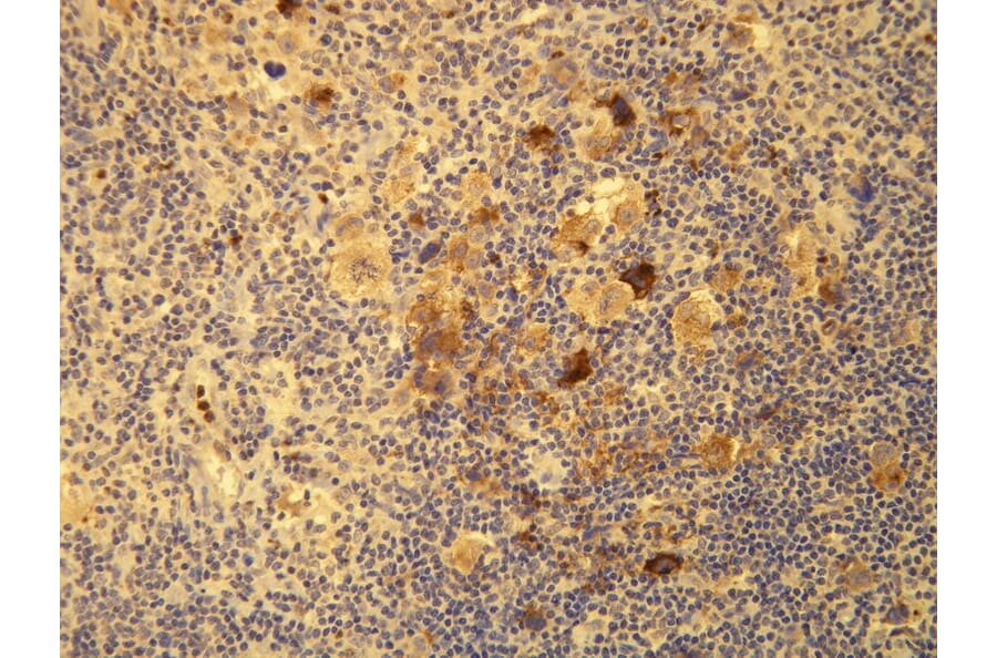 Immunohistochemistry - Anti-EBV Antibody - Antibodies.com (A8206)
