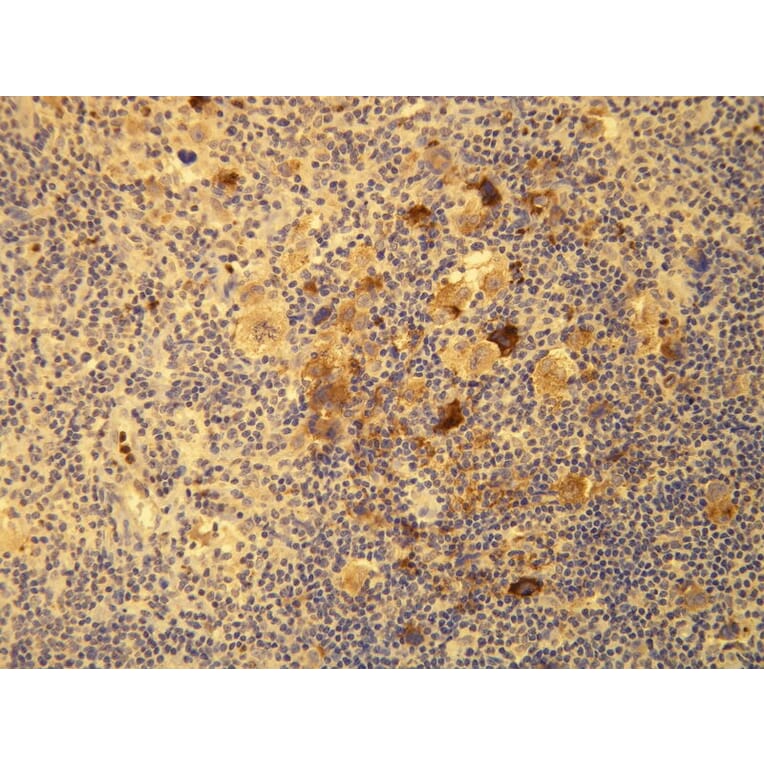 Immunohistochemistry - Anti-EBV Antibody - Antibodies.com (A8206)
