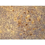 Immunohistochemistry - Anti-EBV Antibody - Antibodies.com (A8206)