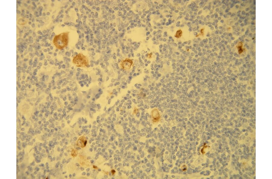 Immunohistochemistry - Anti-EBV Antibody - Antibodies.com (A8207)
