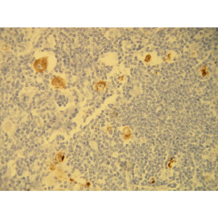 Immunohistochemistry - Anti-EBV Antibody - Antibodies.com (A8207)