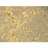 Immunohistochemistry - Anti-EBV Antibody - Antibodies.com (A8207)