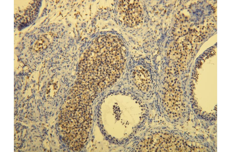 Immunohistochemistry - Anti-CD117 Antibody - Antibodies.com (A8208)