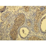 Immunohistochemistry - Anti-CD117 Antibody - Antibodies.com (A8208)