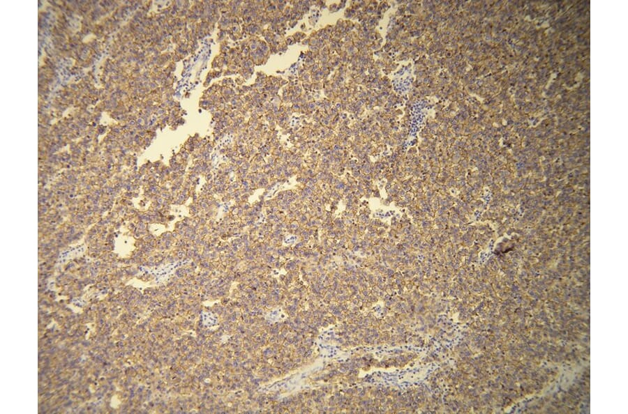 Immunohistochemistry - Anti-CD117 Antibody - Antibodies.com (A8208)