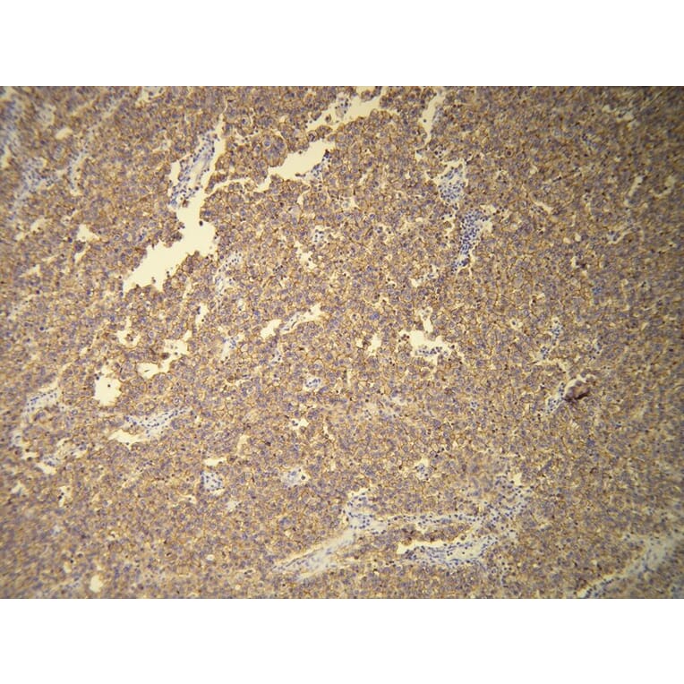 Immunohistochemistry - Anti-CD117 Antibody - Antibodies.com (A8208)