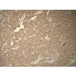 Immunohistochemistry - Anti-CD117 Antibody - Antibodies.com (A8208)