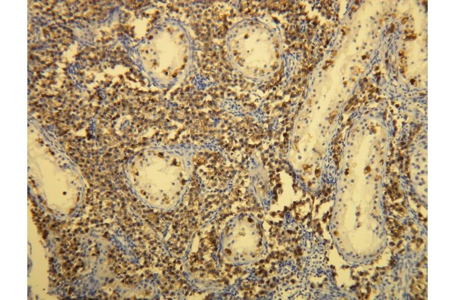 Immunohistochemistry - Anti-CD117 Antibody - Antibodies.com (A8208)
