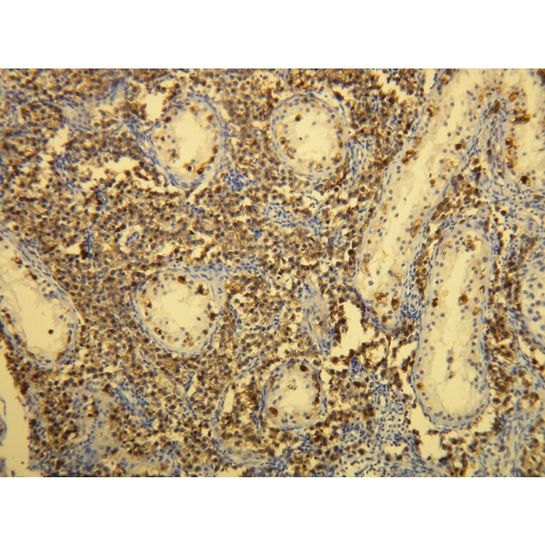 Immunohistochemistry - Anti-CD117 Antibody - Antibodies.com (A8208)