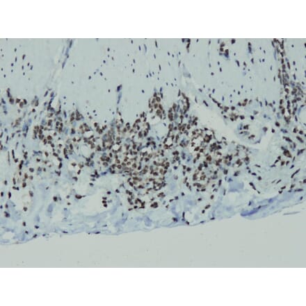 Immunohistochemistry - Anti-Cyclin D1 Antibody - Antibodies.com (A8209)