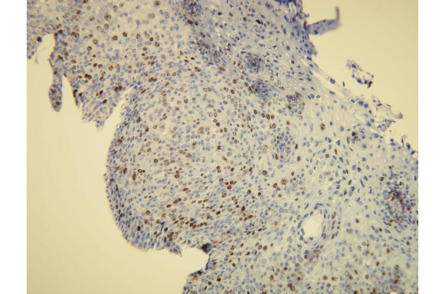 Immunohistochemistry - Anti-Ki-67 Antibody - Antibodies.com (A8210)