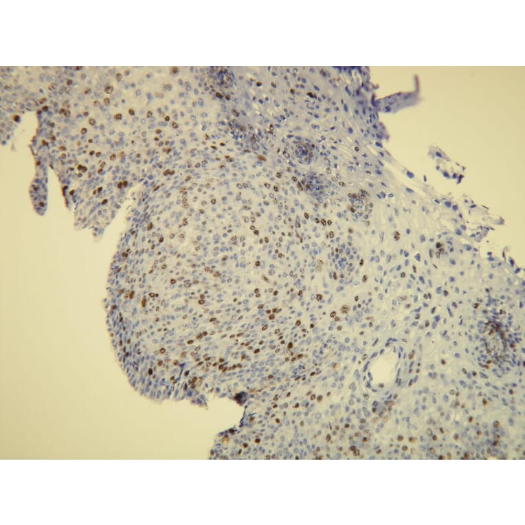 Immunohistochemistry - Anti-Ki-67 Antibody - Antibodies.com (A8210)