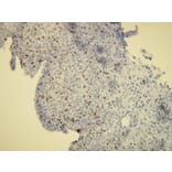 Immunohistochemistry - Anti-Ki-67 Antibody - Antibodies.com (A8210)