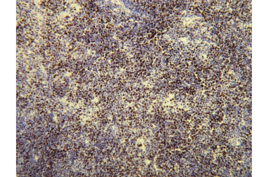Immunohistochemistry - Anti-Ki-67 Antibody - Antibodies.com (A8210)
