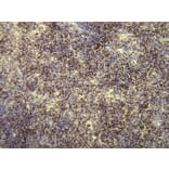 Immunohistochemistry - Anti-Ki-67 Antibody - Antibodies.com (A8210)