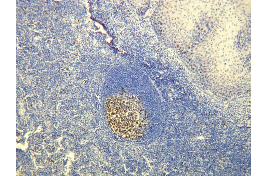 Immunohistochemistry - Anti-Ki-67 Antibody - Antibodies.com (A8210)