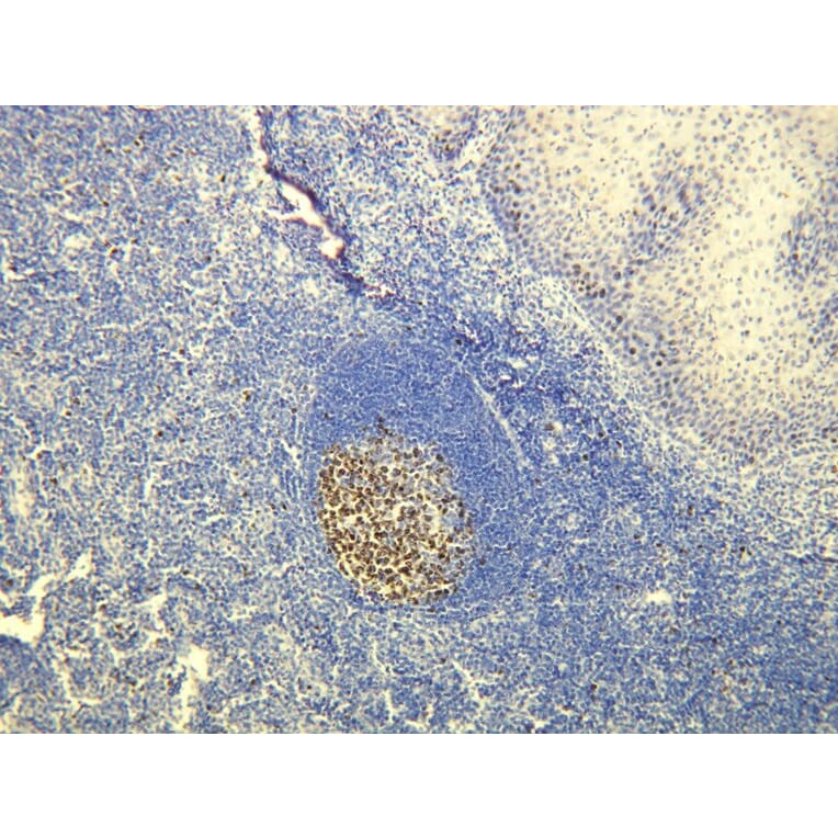 Immunohistochemistry - Anti-Ki-67 Antibody - Antibodies.com (A8210)