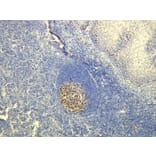 Immunohistochemistry - Anti-Ki-67 Antibody - Antibodies.com (A8210)